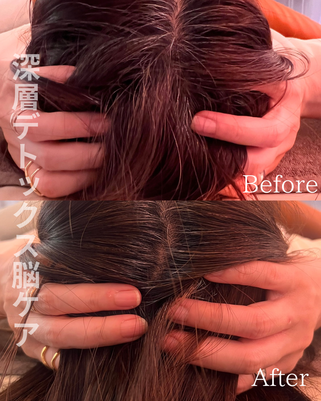 深層デトックス脳ケアの施術前後の一例（Before/After）